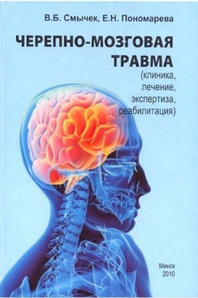 Черепно-мозговая травма